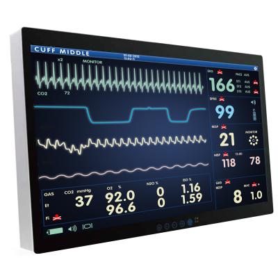 Onyx ACCEL 32" Intel PanelPC 4KL High End Surgical Station